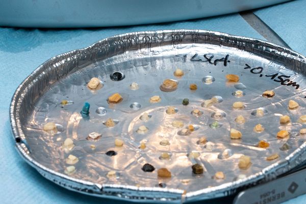 Microplastic samples. Microplastics are smaller than 5 millimeters in diameter